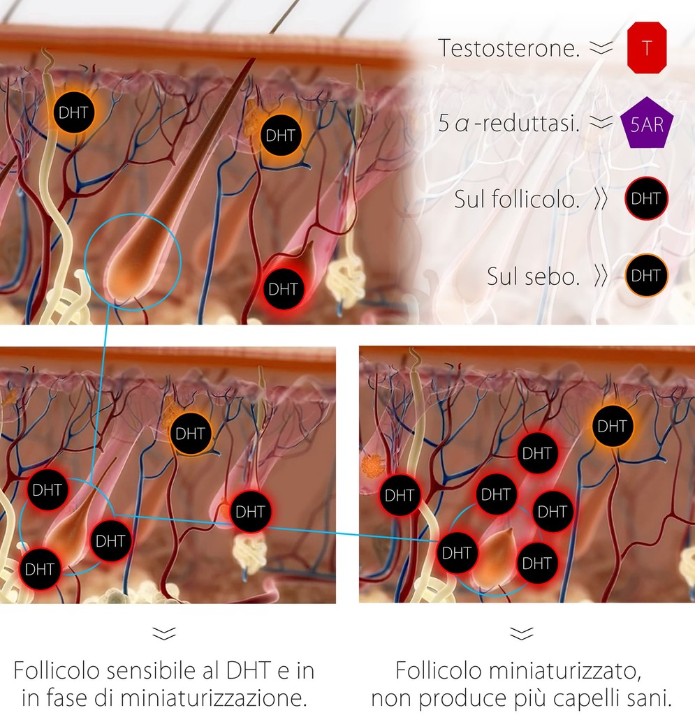 Alopecia Oggi Si Puo Agire Concretamente Torino Oggi