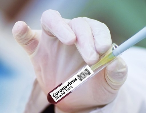Pfizer e l'annuncio atteso da tutto il mondo: &quot;Il nostro vaccino contro il Coronavirus efficace al 90%. Prime dosi entro l'anno&quot;