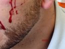 Carcere di Ivrea, detenuto aggredisce un poliziotto e gli spacca un sopracciglio. Osapp: &quot;Si dichiari lo stato di emergenza&quot;