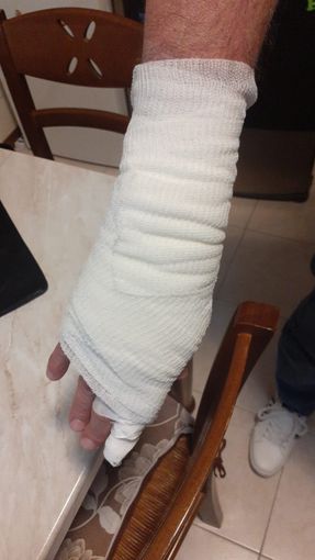 Detenuto straniero ricoverato all'ospedale di Ciriè va fuori di testa e picchia due agenti Detenuto straniero ricoverato all'ospedale di Ciriè va fuori di testa e picchia due agenti