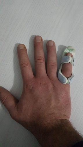 mano ferita mano ferita