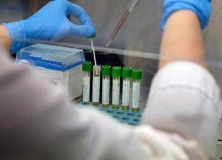 Medicina, italiani svelano errori nascosti nelle cellule: "Possibile ruolo in più malattie" Medicina, italiani svelano errori nascosti nelle cellule: "Possibile ruolo in più malattie"