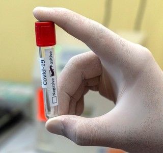 Coronavirus, in Piemonte solo oggi 2.458 contagiati. Ma a preoccupare è l'aumento dei ricoverati in terapia intensiva: +19