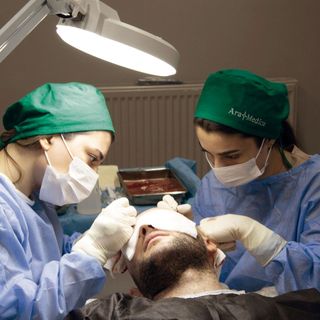 Paesi Top per il trapianto di capelli