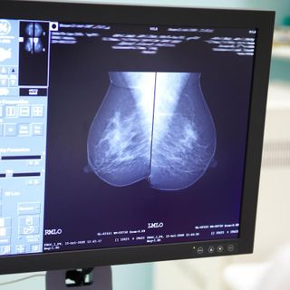 Lo screening può essere più efficace grazie a una start up torinese