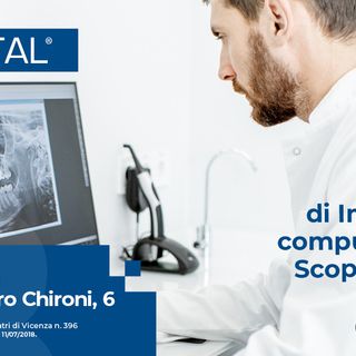 Implantologia computer guidata - la tecnologia a servizio del benessere