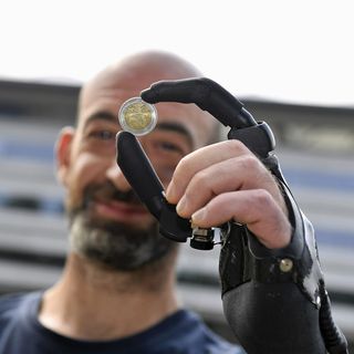 Operaio operato a Torino riacquista la funzionalità della mano sinistra con una protesi bionica [FOTO E VIDEO]