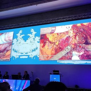 Dal meeting di Torino in anteprima mondiale la chirurgia urologica entra nel metaverso