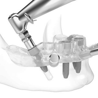 Il Mauriziano all'avanguardia nella cura dei denti su pazienti sensibili