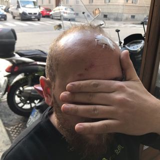 il barista aggredito dagli anarchici