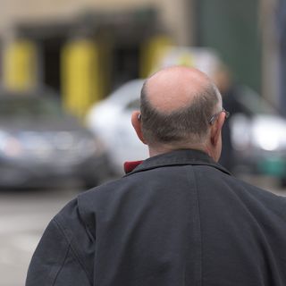 Protesi capelli per uomo, la soluzione amatissima anche dai VIP