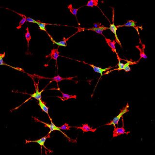 cellule cerebrali