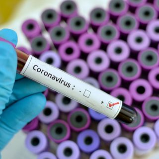 Coronavirus, Uncem:&quot;Necessario ridurre provvedimenti di prevenzione, necessario ritorno alla normalità&quot;