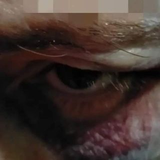 Discussione degenera in rissa: disabile picchiato da un giovane in Barriera di Milano