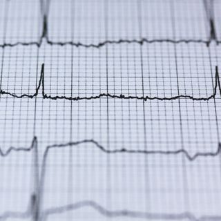 Come viene svolto un elettrocardiogramma