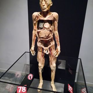 Human Bodies, il corpo umano si rivela agli occhi dei torinesi (e cerca di schivare le polemiche)