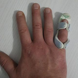 mano ferita