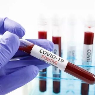 Covid: 1.549 nuovi casi in Piemonte, positività al 10,9%