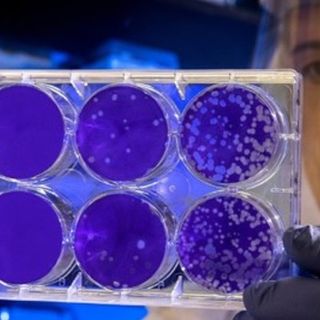 Covid: tutte le analisi del sangue per stare tranquilli