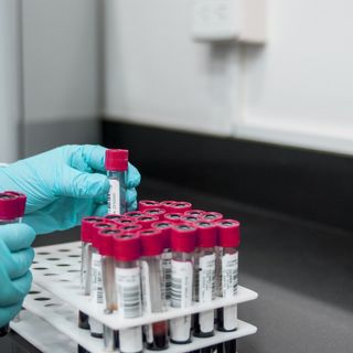 Coronavirus, quasi 4 mila test sierologici prenotati per il personale della scuola