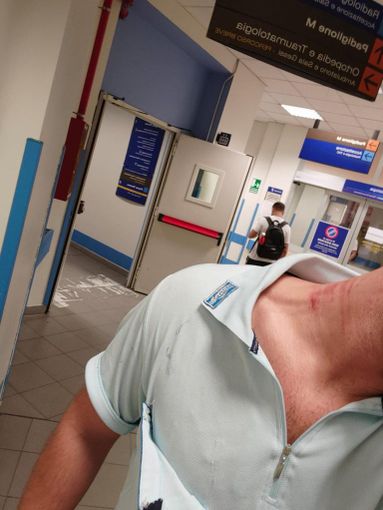 Persona con segni sul collo all'ospedale