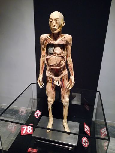 Human Bodies, il corpo umano si rivela agli occhi dei torinesi (e cerca di schivare le polemiche)