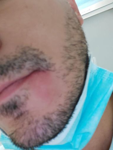 ispettore aggredito ispettore aggredito