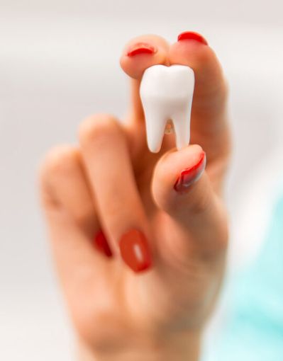 Estrazione dente: quando è necessaria e a chi affidarsi Estrazione dente: quando è necessaria e a chi affidarsi