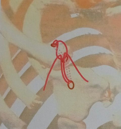 Esami medici di una clavicola