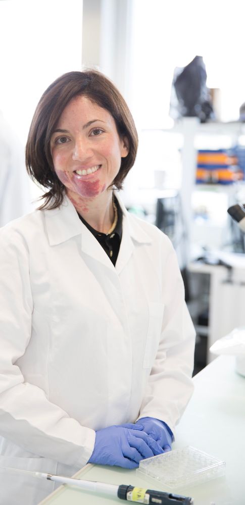 GiovedìScienza: incontro con Maria Teresa Ferretti sul nuovo approccio alla malattia di Alzheimer GiovedìScienza: incontro con Maria Teresa Ferretti sul nuovo approccio alla malattia di Alzheimer