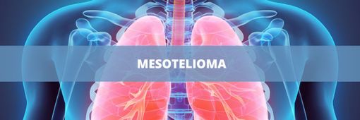 L’elettricità corre sull’amianto: condannata l’ENEL