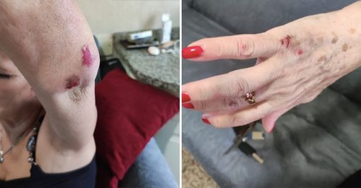 aggressione barriera milano
