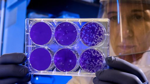 Coronavirus: dal Seremi le indicazioni per le Asl piemontesi