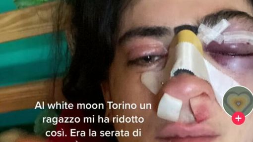 Il post della ragazza aggredita al White Moon