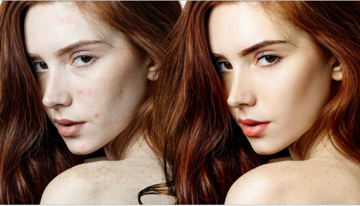 Base trucco: come scegliere e perché è indispensabile? Base trucco: come scegliere e perché è indispensabile?