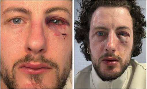 I segni delle violenze pubblicati sui social I segni delle violenze pubblicati sui social