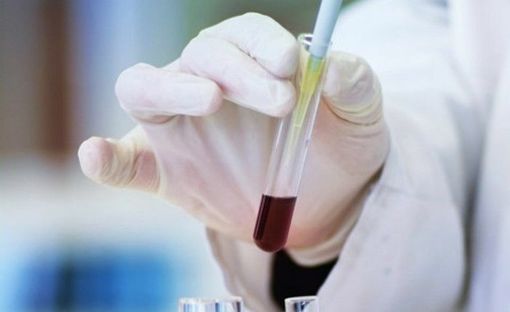 Giornata del Cancro: dal “caring massage” alla realtà immersiva, l’IRCCS di Candiolo rende le cure più “umane” Giornata del Cancro: dal “caring massage” alla realtà immersiva, l’IRCCS di Candiolo rende le cure più “umane”