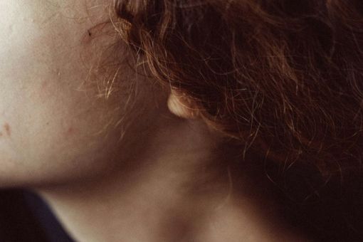 Dermatochirurgia: Come i Trattamenti Chirurgici Possono Migliorare la Tua Pelle Dermatochirurgia: Come i Trattamenti Chirurgici Possono Migliorare la Tua Pelle