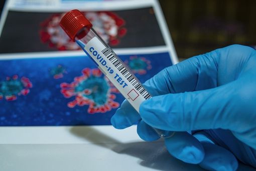 Coronavirus, soltanto 5 persone ancora in terapia intensiva in tutto il Piemonte, nessun decesso