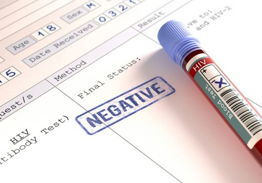 Test HIV e prevenzione al campus Luigi Einaudi: le lunghe trattative per il sì