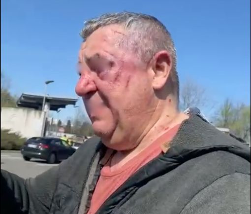 L'uomo ferito a seguito dello scippo al suk della Colletta