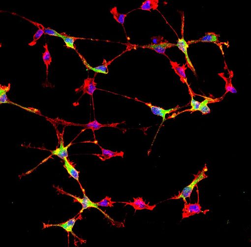 cellule cerebrali