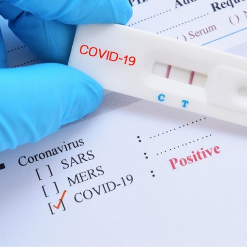 Covid, la Regione al lavoro per un monitoraggio con test rapidi e molecolari degli over 65enni asintomatici affetti da malattie croniche