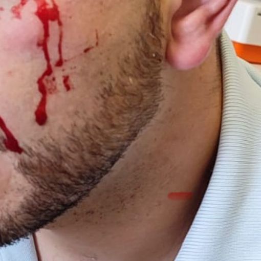 Carcere di Ivrea, detenuto aggredisce un poliziotto e gli spacca un sopracciglio. Osapp: &quot;Si dichiari lo stato di emergenza&quot;