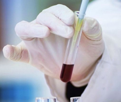Oggi è la Giornata Mondiale contro il Cancro per aumentare la consapevolezza sulla malattia