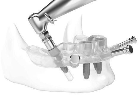 Il Mauriziano all'avanguardia nella cura dei denti su pazienti sensibili