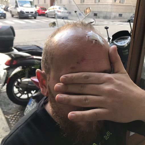 il barista aggredito dagli anarchici