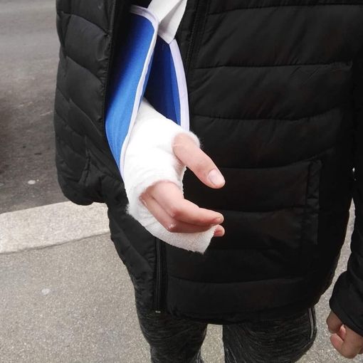 Mano fratturata a uno studente di una scuola media di Torino: padre denuncia professore