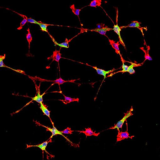 cellule cerebrali