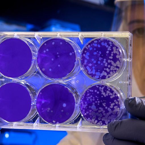 Coronavirus, altri 53 decessi in Piemonte. Il totale sfiora i 600
